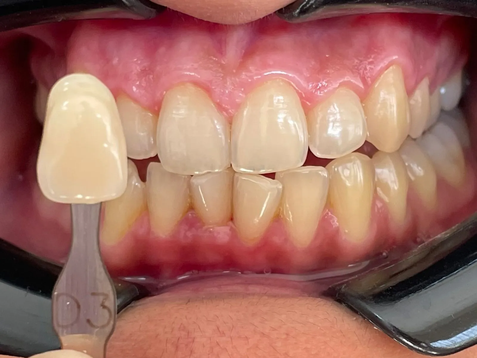 top dental clinic Chandigarh