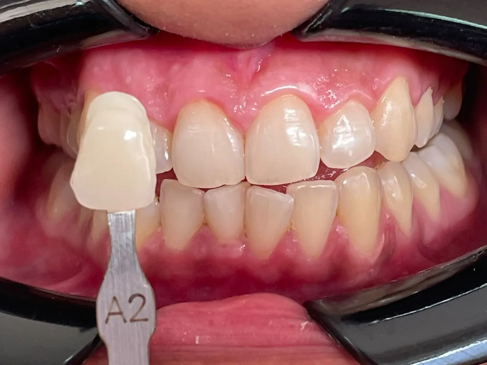 affordable dental clinic Chandigarh