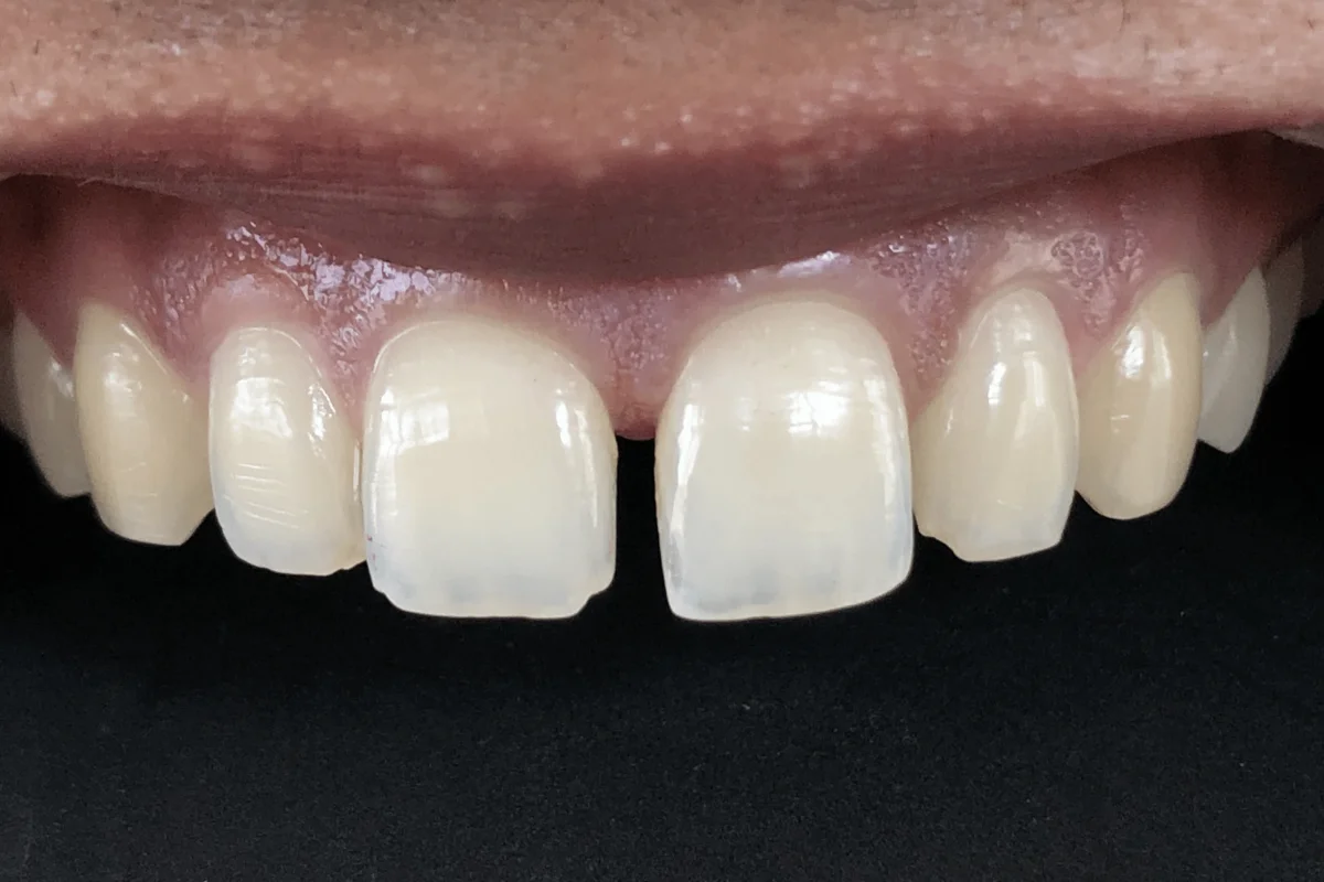 Best dental clinic in Sector 44D Chandigarh - TeethTime