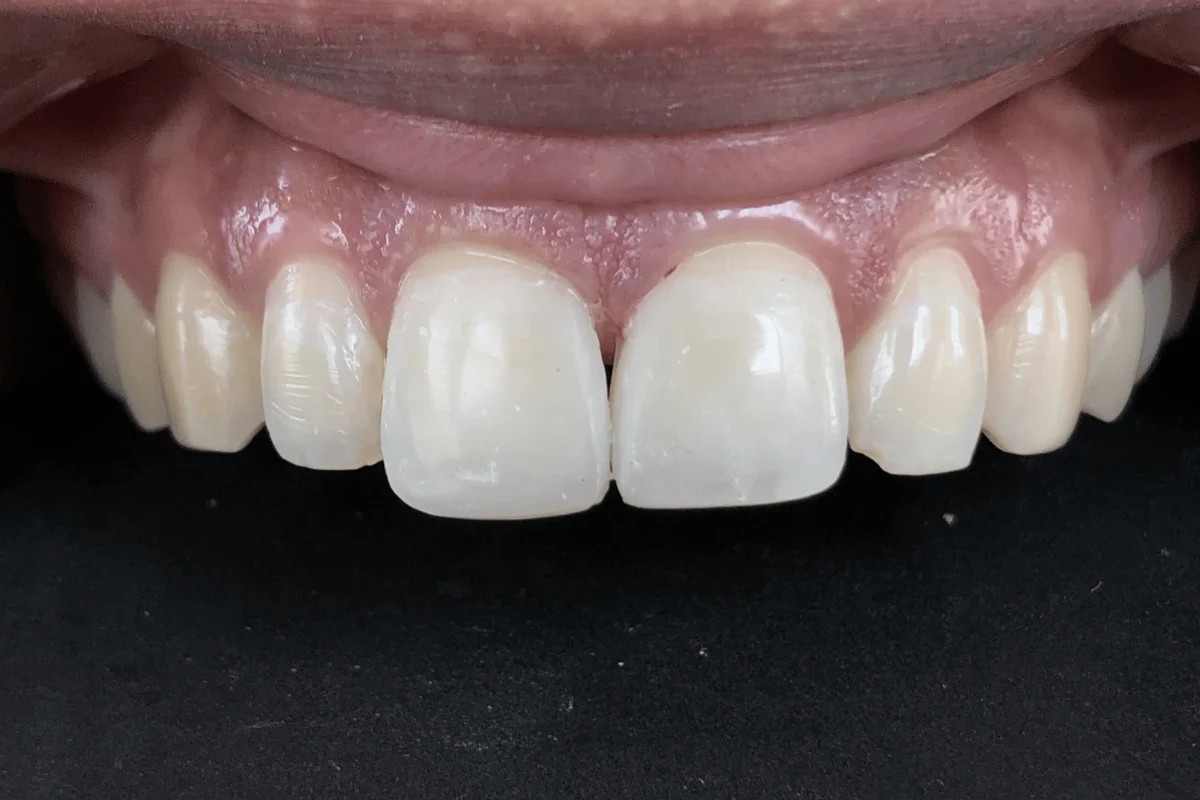 best dental clinic in chandigarh
