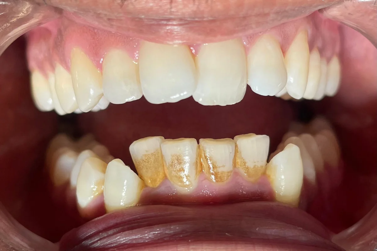 dental clinic chandigarh near me