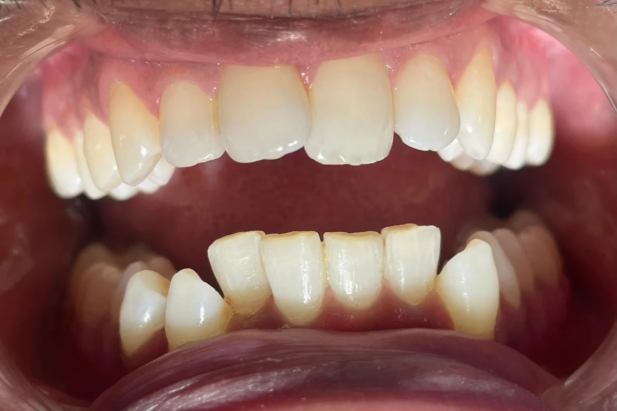 best dental clinic in chandigarh