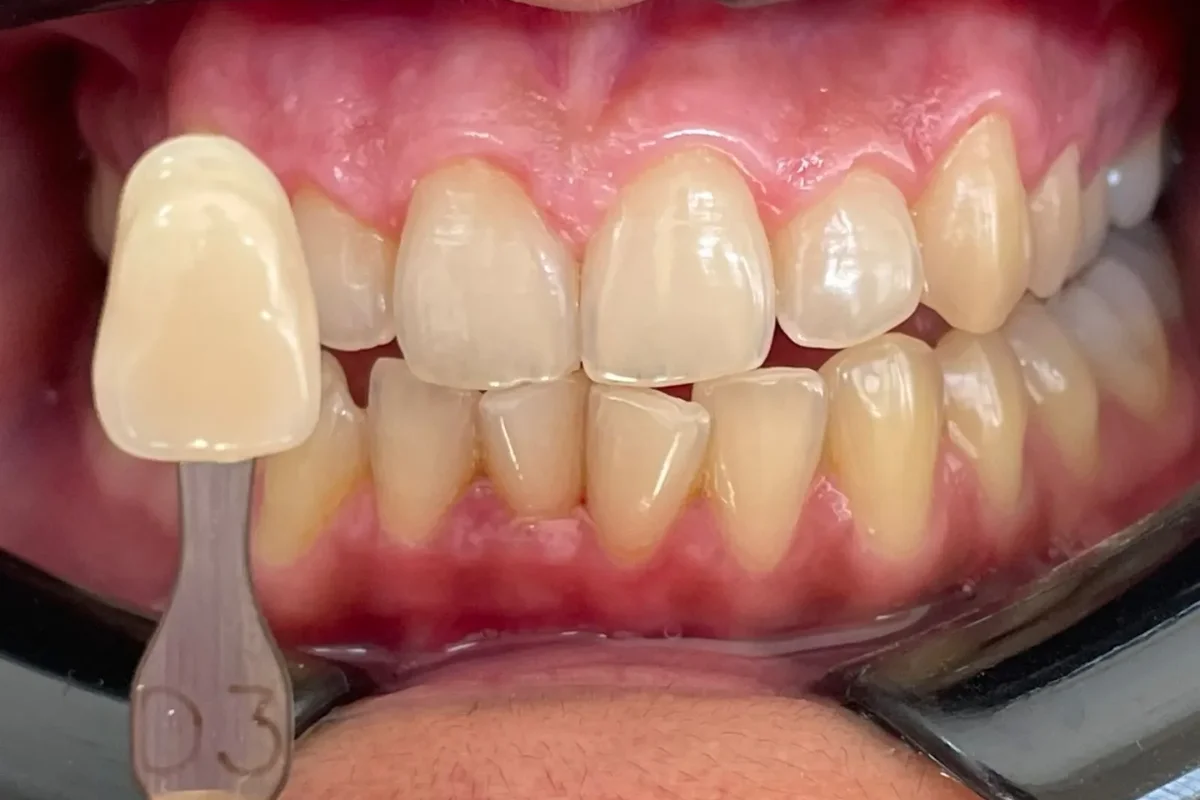 top dental clinic Chandigarh