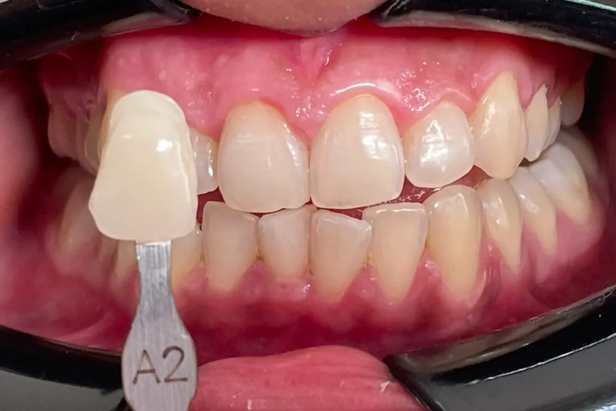 affordable dental clinic Chandigarh